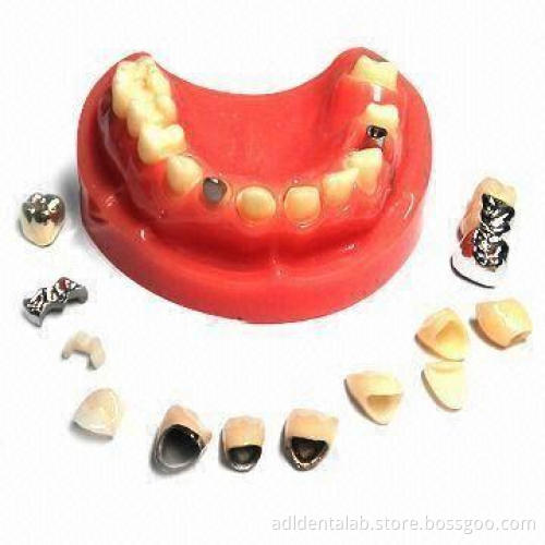 Dental Samples, Zirconia, PFM, Inlay, FMC, Captet, Glod, Emax